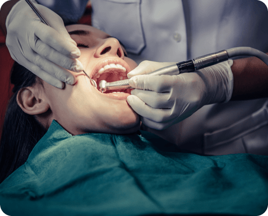 Root canal Treatment