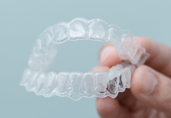 Invisible Aligners