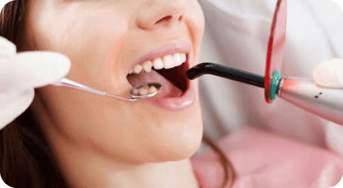 teeth braces in Bangalore