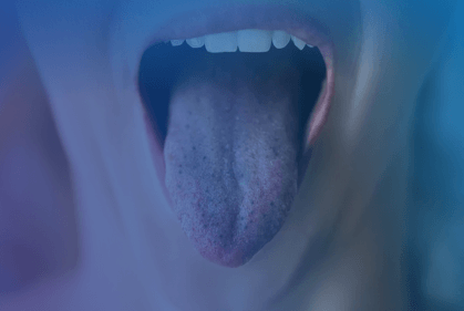 black spots on tongue