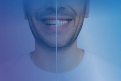 how to remove stains from teeth