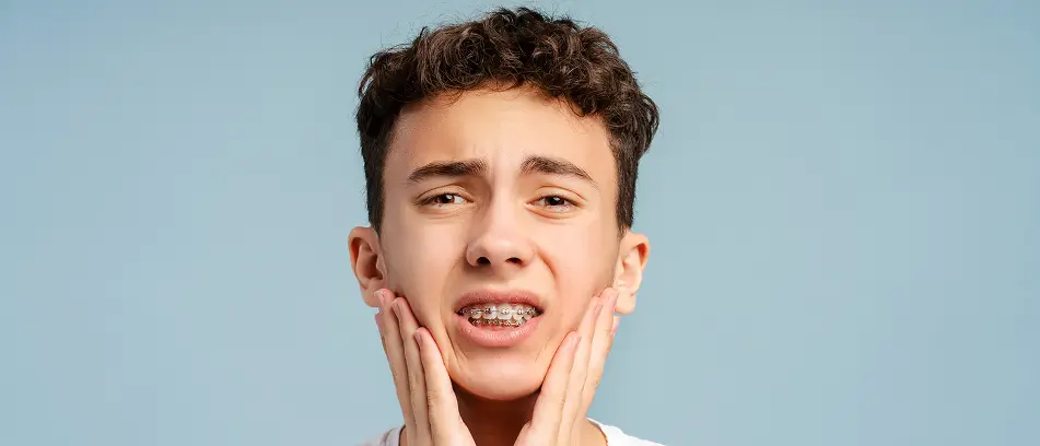 braces for teeth