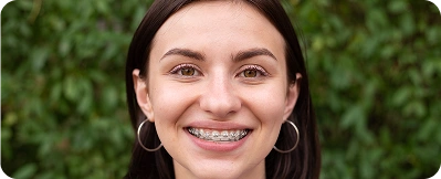 Adults aged 18+ with braces treatment at Power Smiles Dental