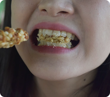 Close-up of teeth biting into food showing bite alignment