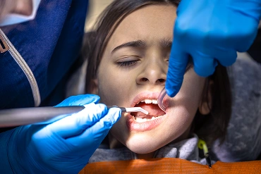 Image for fluoride treatments for children's teeth