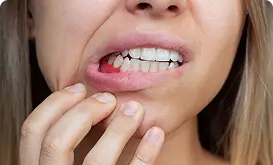 Image showing gum recession and teeth appearing longer