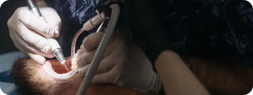 Dentist cleaning and repairing gum tissue after surgery