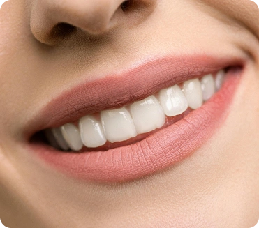 Close-up of a straight, healthy smile after braces treatment