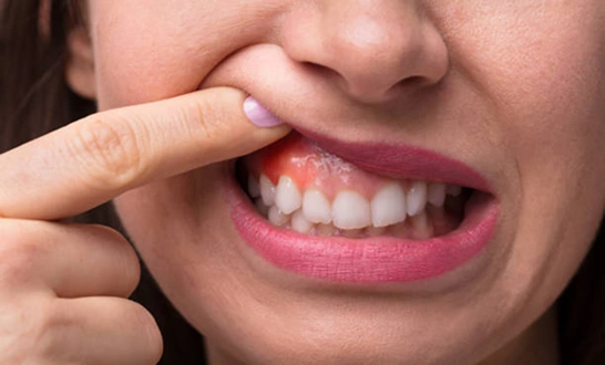 Best dental implants in Bangalore