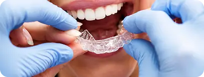 Dentist fitting a custom oral splint for TMJ treatment