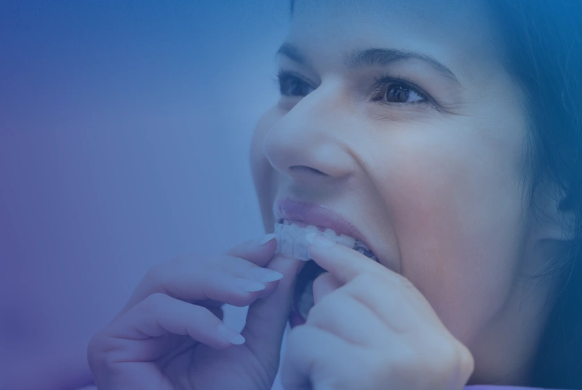 Is Invisible Aligners Effective