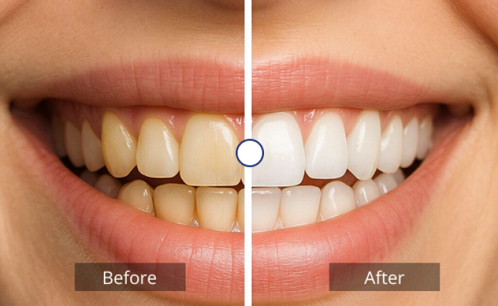 Dental clinic in Jayanagar